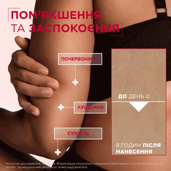Mixa Urea Cica Repair+Renewing Cream