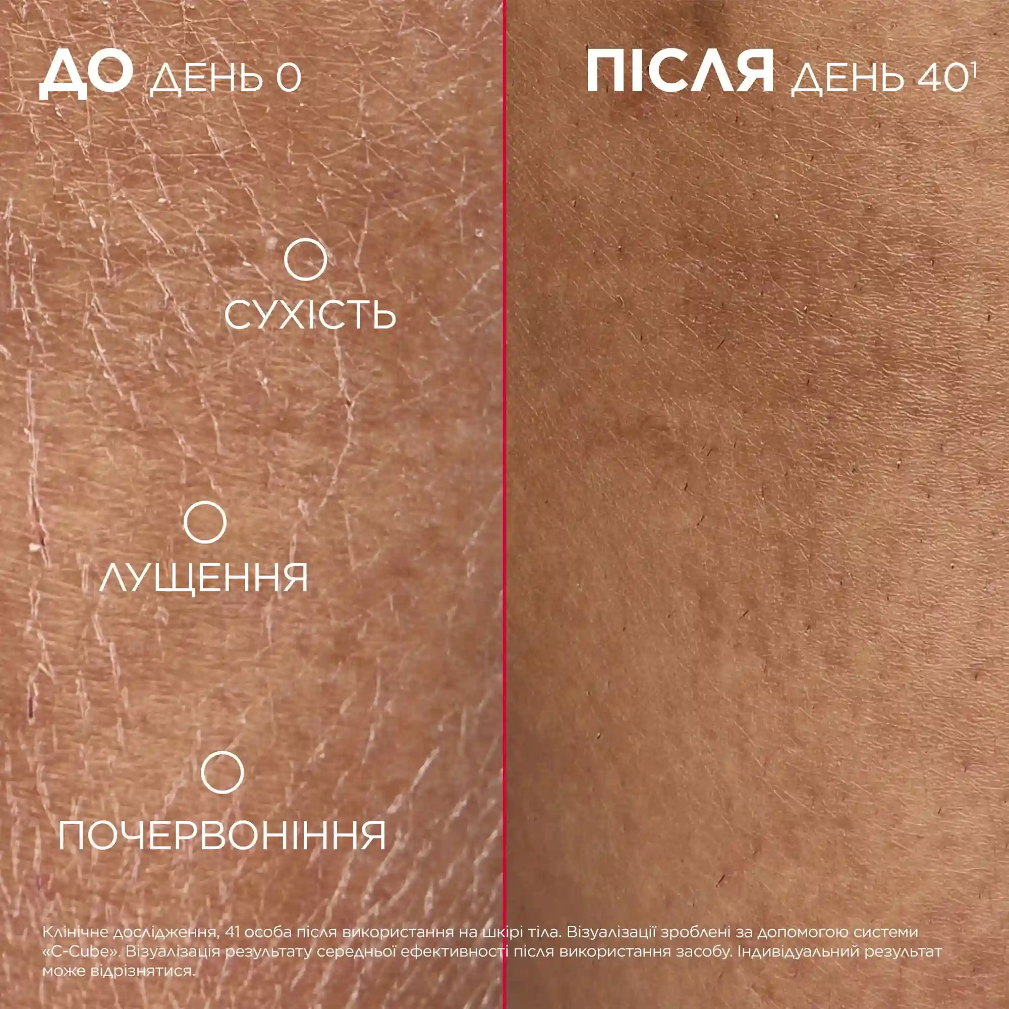 Mixa Urea Cica Repair+Renewing Cream