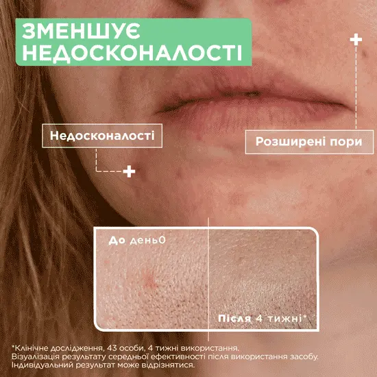 Mixa Anti-Imperfection Serum