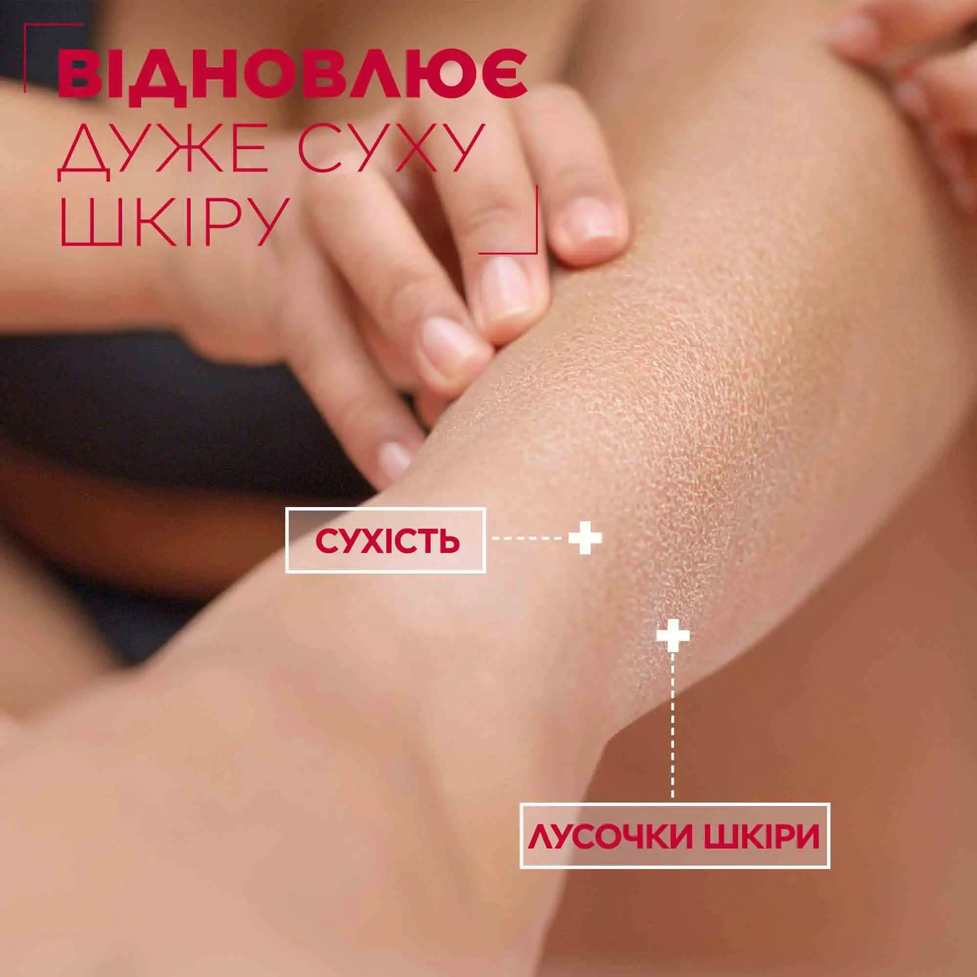 Mixa Urea Cica Repair+Body Milk